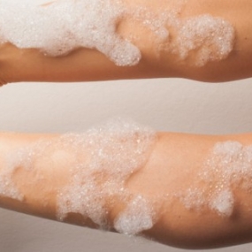 Hirsutisme et solution naturelle : le sérum anti-repousse bio Acorelle